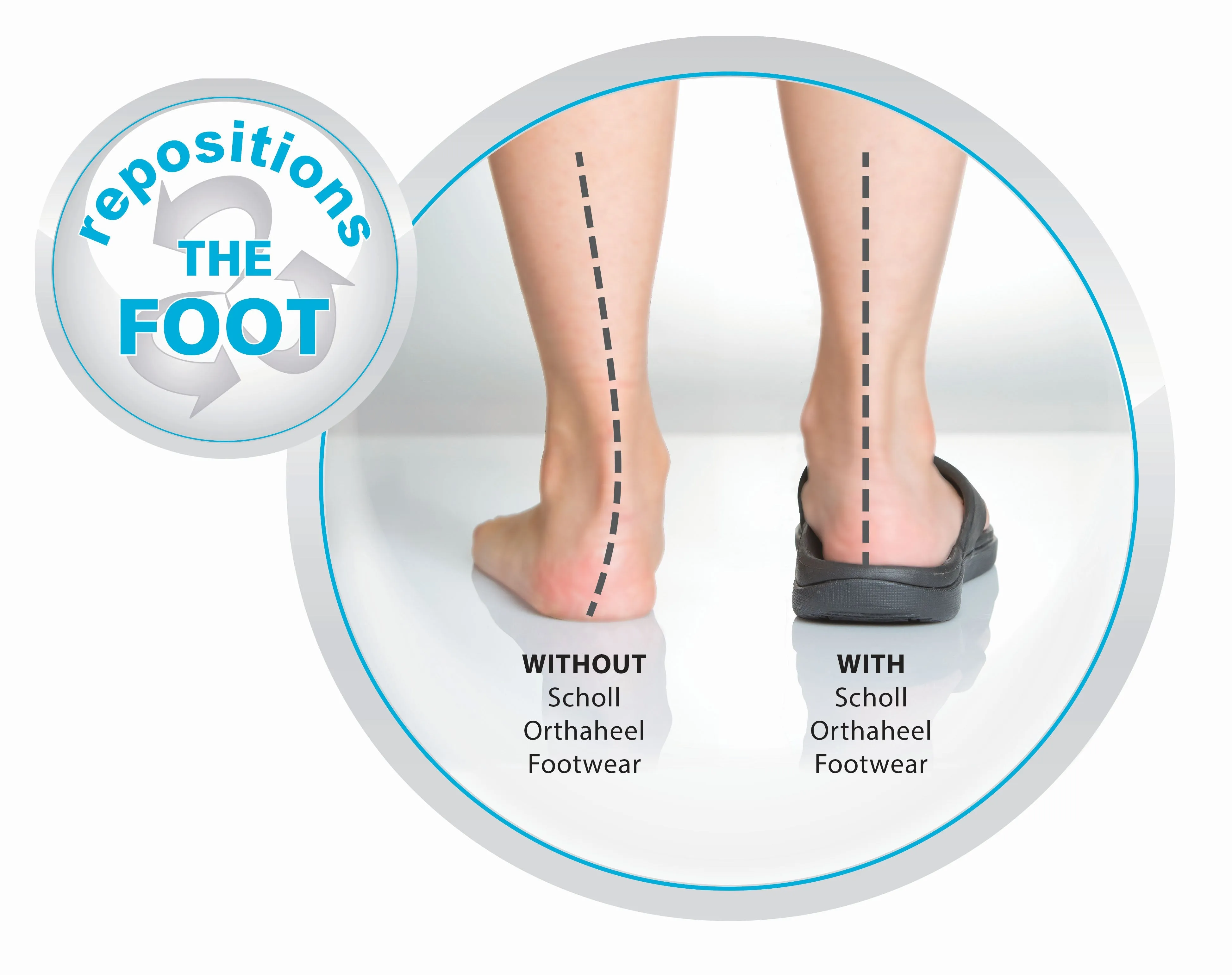 Scholl Orthaheel Wave II Womens Comfort Orthotic Thongs With Support